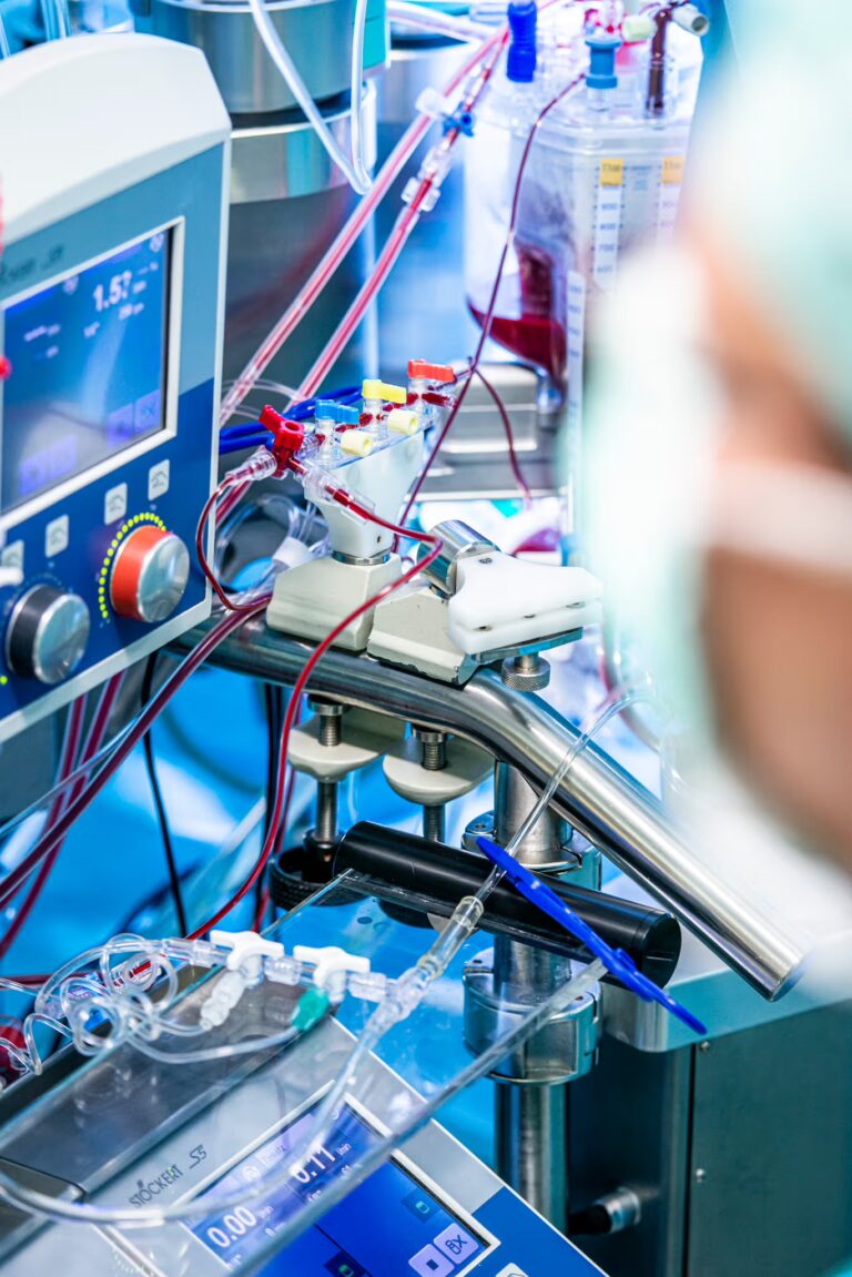 Detailaufnahme medizinischer Geräte und Schläuche mit Blutleitungen in einer klinischen Umgebung.